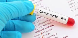 Cardiac Injury Markers I