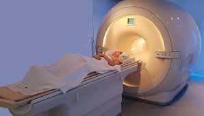 Advanced Angio CT Scan – Precise Vascular Imaging (Excludes Coronary)