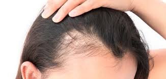 Hair Fall Test Extensive