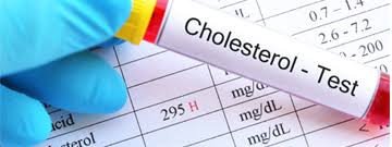 Cholesterol-HDL Supplement for Heart Health – Boost Good Cholesterol, Reduce LDL, and Support Cardiovascular Wellness with Omega-3, Niacin, and Antioxidants