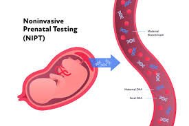 Basic NIPT - Non Invasive Prenatal Test