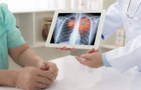 NGS Lung Cancer Panel