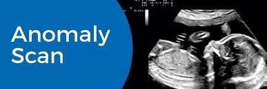 Anomaly Scan - Ultrasound