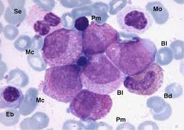 Oncomine Juvenile myelomonocytic Leukemia (JMML) panel
