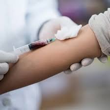 Thyroid Binding Globulin (TBG) for Accurate Thyroid Hormone Analysis