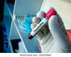 Theophylline Serum Test