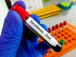 Rapamycin (Sirolimus) Serum Test