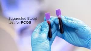 PCOS Blood Test