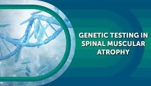 SPINAL MUSCULAR ATROPHY (SMA) Test – Fast & Accurate Genetic Screening