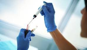 STD Test & Same Day Results