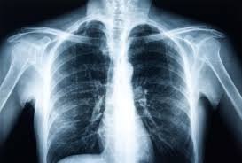 Quick & Affordable X-Ray Single View Imaging