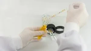 تحليل نسبة البروتين إلى الكرياتينين في البول العشوائي (PCR Urine Test)
