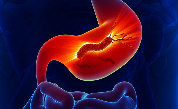 HELICOBACTER PYLORI Ag Test (H PYLORI Ag)