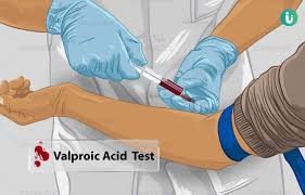 Valproic Acid (Depakin Level) Serum Test - Accurate Enzyme-Immunoassay for Epilepsy, Bipolar Disorder, and Migraine Management