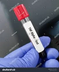 اختبار عامل النخر الورمي (TNF)
