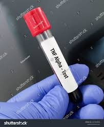 High-Purity Tumor Necrosis Factor (TNF) Test