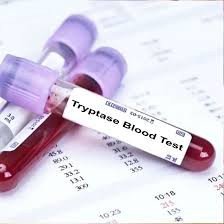Tryptase Enzyme Test