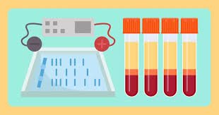 Urine Immunofixation Test (Immuno Electrophoresis) – Accurate Detection of Monoclonal Proteins for Plasma Cell Disorders Diagnosis