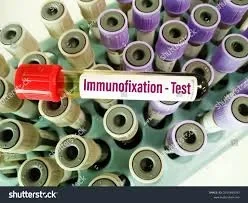 التثبيت المناعي (الرحلان الكهربي المناعي) في دبي – Immuno Fixation Test