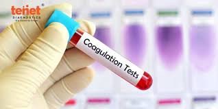Coagulation Profile