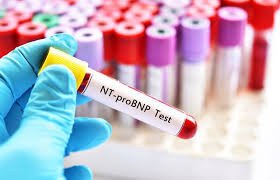 proBrain Natriuretic Peptide (proBNP) Test