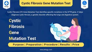 Cystic Fibrosis Mutation Screening (delF508)