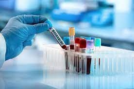 STD Testing Dubai