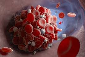 Prothrombin Mutation Analysis – Accurate DNA Analysis for Thrombophilia Detection