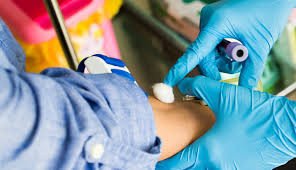 High-Purity Chloride for Serum Testing – Ion-Selective Electrodes Method, 1-Day TAT