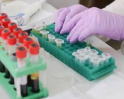 TPMT Enzyme Activity Test - Accurate Thiopurine Methyltransferase Analysis for Personalized Medicine