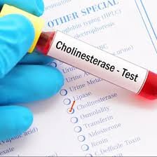 High-Purity Cholinesterase Enzyme for Serum Analysis | Flow Cytometry | Neurobiological Research & Diagnostics | 10-Day TAT