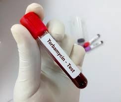 Tobramycin Serum Test
