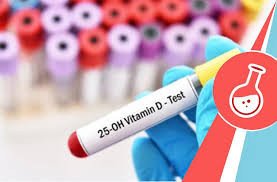 25-OH Vitamin D Test
