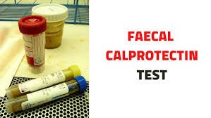 Calprotectin Test