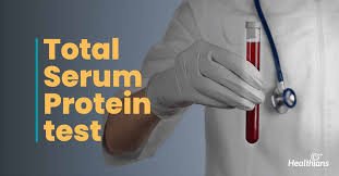 Protein-Total Test