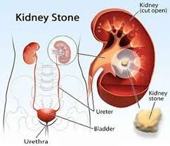 24-Hour Urine Citrate Test for Kidney Stone Prevention | Accurate Spectrophotometry Analysis for Optimal Kidney Health