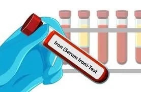 اختبار تشبع الترانسفيرين (الحديد، TIBC)