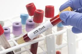 STD Testing Packages