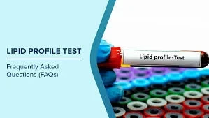 تحليل Lipid Profile II