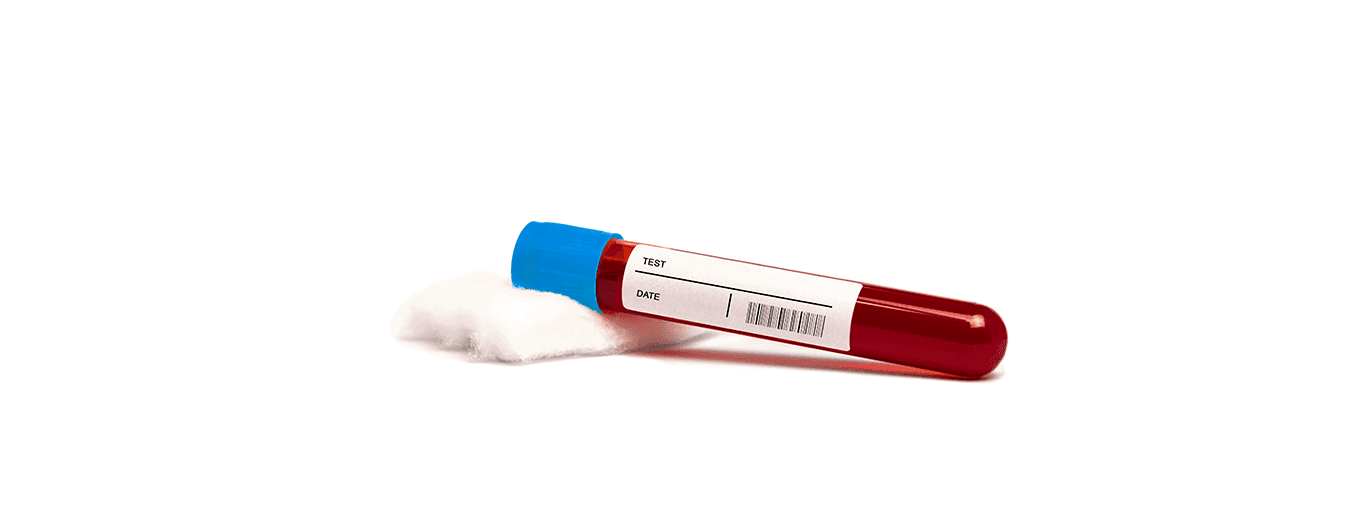 Mycotoxin Blood Test