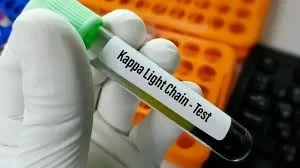 اختبار كابا لايت تشين في البول – Kappa Light Chain (Urine) Test