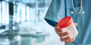 Comprehensive Creatinine Clearance Test (24-Hour Urine & Serum) – Accurate Kidney Function Assessment with Spectrophotometry