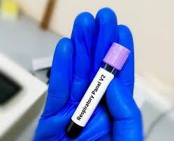 Respiratory comprehensive 25 Pathogens (12 Hrs)