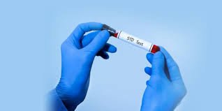 STD Screening Dubai