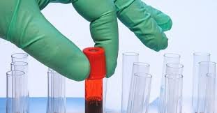 High-Precision Catecholamines Plasma Test – Measure Epinephrine, Norepinephrine & Dopamine for Hypertension, Neuroendocrine Tumors, and Autonomic Dysfunction Diagnosis