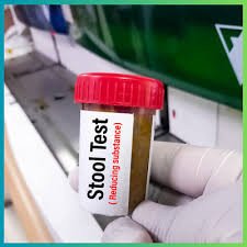 Reducing Substances (Stool) Test Kit – Accurate, Rapid Detection of Carbohydrate Malabsorption for Digestive Health